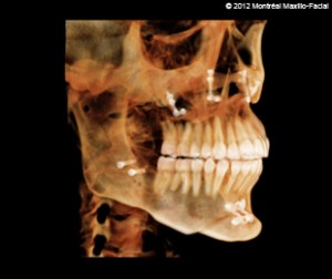 Digital image of a jaw
